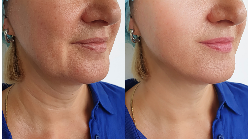 Estriol+GHK-CU+Hyalaronic acid Anti-aging Skin Cream