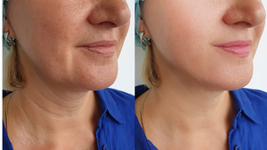 Estriol+GHK-CU+Hyalaronic acid Anti-aging Skin Cream